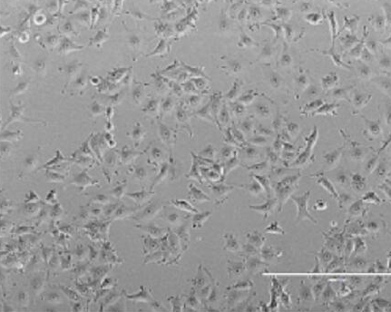 Mahlavu人肝癌細(xì)胞