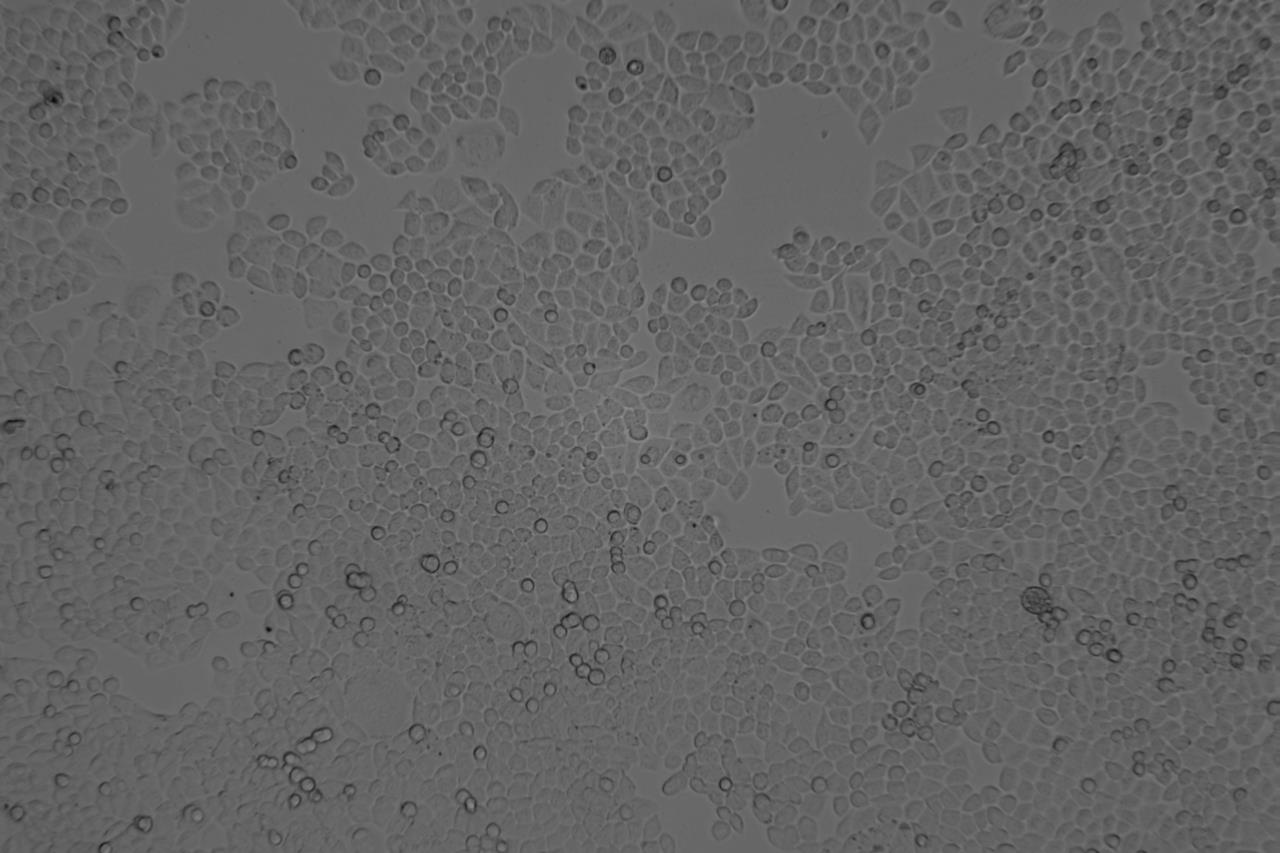 HCT-8/FU 人結(jié)腸癌氟尿嘧啶耐藥株