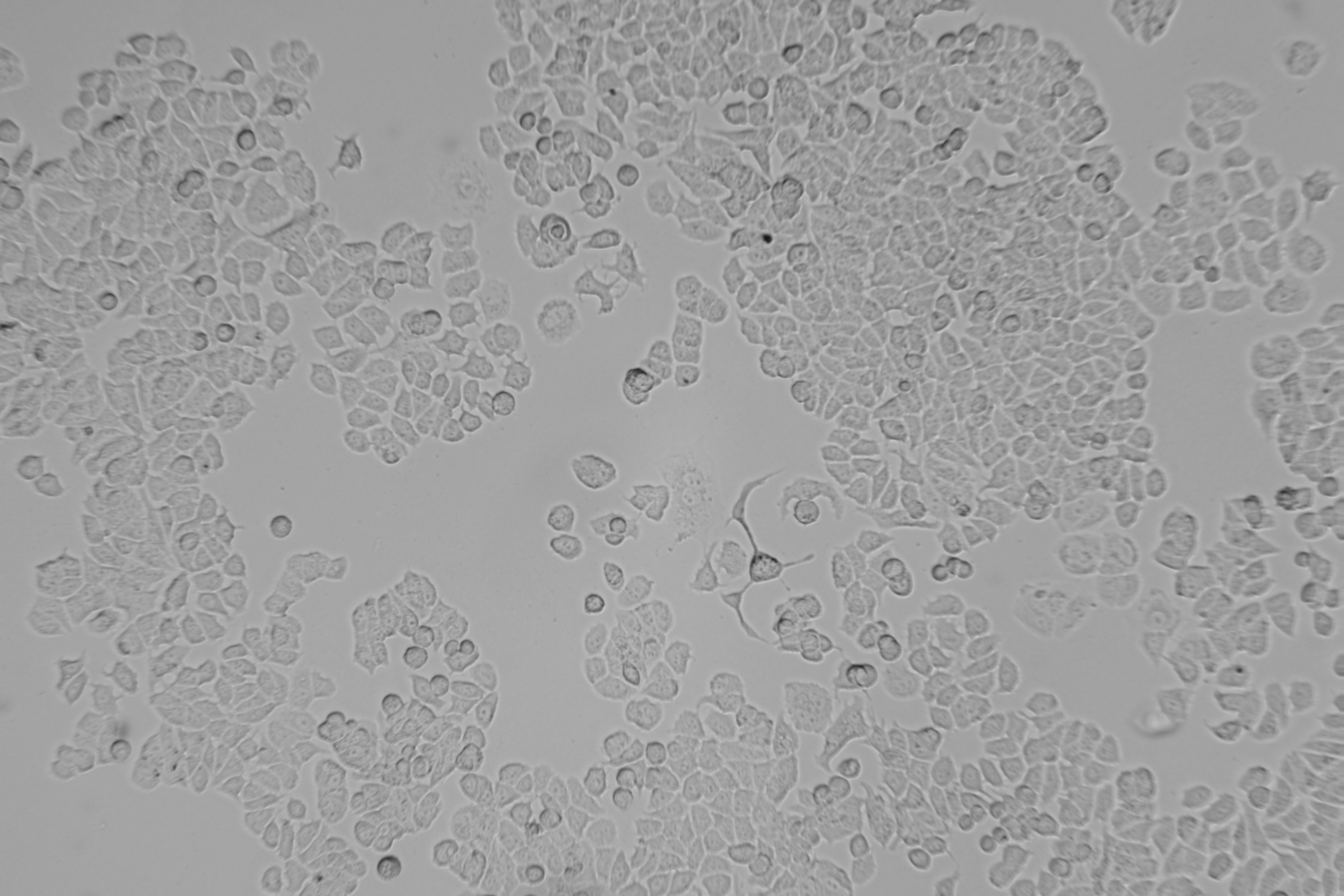 人乳腺癌順鉑耐藥株MCF7/DDP